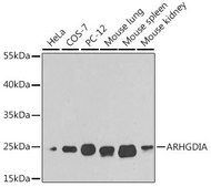 Anti-ARHGDIA antibody produced in rabbit