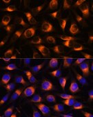 Anti-VAT1 antibody produced in rabbit