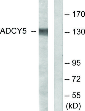 Anti-ADCY5, C-Terminal antibody produced in rabbit affinity isolated antibody