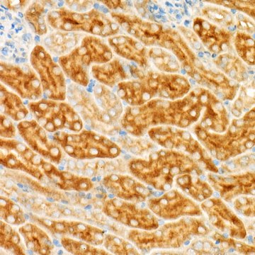 Anti-GCN2 Antibody, clone 1G2Z4, Rabbit Monoclonal