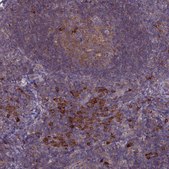 Anti-IL21R antibody produced in rabbit Prestige Antibodies® Powered by Atlas Antibodies, affinity isolated antibody, buffered aqueous glycerol solution