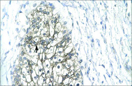 Anti-MMP19 (AB2) antibody produced in rabbit IgG fraction of antiserum
