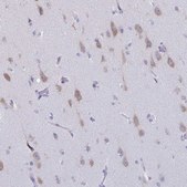 Anti-CELF5 antibody produced in rabbit Prestige Antibodies® Powered by Atlas Antibodies, affinity isolated antibody, buffered aqueous glycerol solution