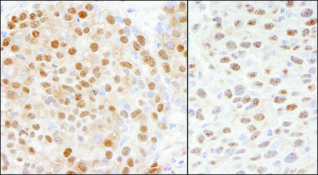 Rabbit anti-Cul4a Antibody, Affinity Purified Powered by Bethyl Laboratories, Inc.