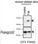 Anti-phospho RasGRP2 (Ser586) from rabbit