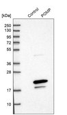 Anti-POMP antibody produced in rabbit Prestige Antibodies® Powered by Atlas Antibodies, affinity isolated antibody, buffered aqueous glycerol solution