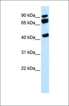 Anti-DDX17 antibody produced in rabbit affinity isolated antibody