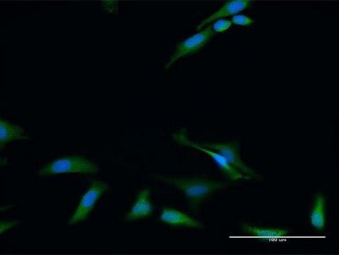 Anti-RIOK2 antibody produced in rabbit purified immunoglobulin, buffered aqueous solution