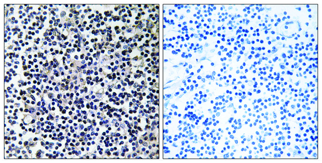 Anti-TACC3 antibody produced in rabbit affinity isolated antibody