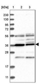 Anti-PAK1IP1 antibody produced in rabbit Prestige Antibodies® Powered by Atlas Antibodies, affinity isolated antibody, buffered aqueous glycerol solution