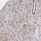 Anti-EDEM3 antibody produced in rabbit Prestige Antibodies® Powered by Atlas Antibodies, affinity isolated antibody, buffered aqueous glycerol solution, Ab2
