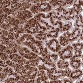 Anti-TPP1 antibody produced in rabbit Prestige Antibodies® Powered by Atlas Antibodies, affinity isolated antibody, buffered aqueous glycerol solution