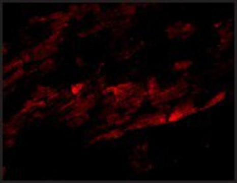 Anti-SPG15 antibody produced in rabbit affinity isolated antibody, buffered aqueous solution