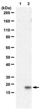 Anti-CTGF Antibody, C-Term from goat, purified by affinity chromatography