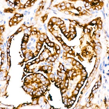 Anti-Thyroglobulin Antibody, clone 3I10H1, Rabbit Monoclonal