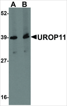 Anti-UROP11 antibody produced in rabbit affinity isolated antibody, buffered aqueous solution