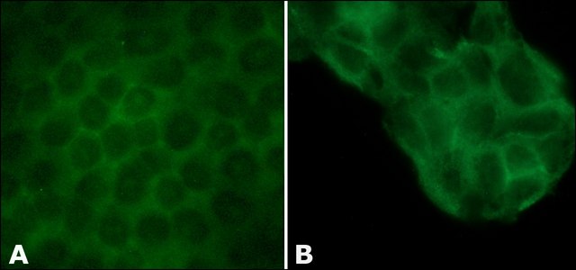 Anti-l-Afadin antibody produced in rabbit affinity isolated antibody, buffered aqueous solution