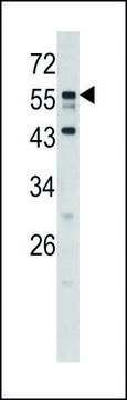 ANTI-DONSON (N-TERM) antibody produced in rabbit IgG fraction of antiserum, buffered aqueous solution