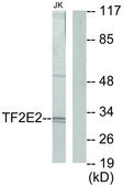 Anti-TF2E2 antibody produced in rabbit affinity isolated antibody