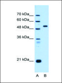 Anti-ST14 antibody produced in rabbit affinity isolated antibody