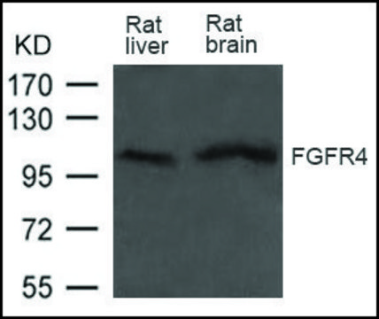 Anti-FGFR4 antibody produced in rabbit affinity isolated antibody