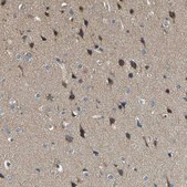 Anti-TMCC2 antibody produced in rabbit Prestige Antibodies® Powered by Atlas Antibodies, affinity isolated antibody, buffered aqueous glycerol solution