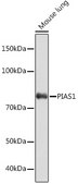 Anti-PIAS1 Antibody, clone 3J2O8, Rabbit Monoclonal
