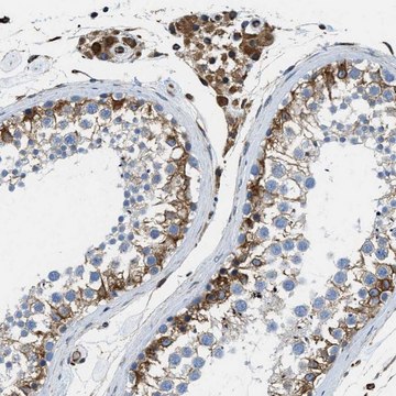 抗-HSD17B12 兔抗 Prestige Antibodies&#174; Powered by Atlas Antibodies, affinity isolated antibody, buffered aqueous glycerol solution