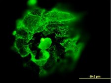 Monoclonal Anti-TP53 antibody produced in mouse clone 2C3, purified immunoglobulin, buffered aqueous solution