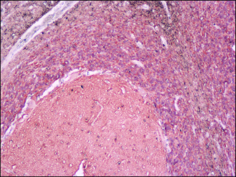 Anti-Neuron-Specific Enolase (NSE) antibody, Mouse monoclonal clone NSE-P2, purified from hybridoma cell culture