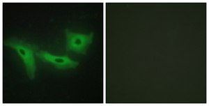 Anti-LRRK1 antibody produced in rabbit affinity isolated antibody