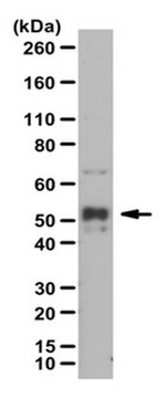 Anti-phospho NFkB p52, (Ser222) Antibody from rabbit, purified by affinity chromatography