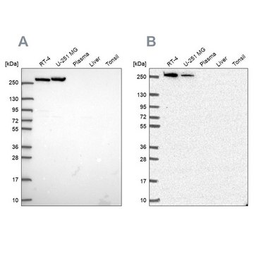 Anti-CAD antibody produced in rabbit Prestige Antibodies&#174; Powered by Atlas Antibodies, affinity isolated antibody