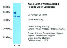 Anti-SLC2A2 affinity isolated antibody