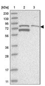 Anti-TARS2 antibody produced in rabbit Prestige Antibodies® Powered by Atlas Antibodies, affinity isolated antibody, buffered aqueous glycerol solution