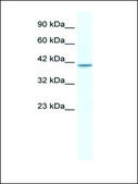 Anti-TBX1 IgG fraction of antiserum