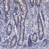 Anti-ATP6V1G2 antibody produced in rabbit Prestige Antibodies® Powered by Atlas Antibodies, affinity isolated antibody, buffered aqueous glycerol solution