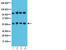 Anti-PP2A-B’ (B56) Antibody from rabbit