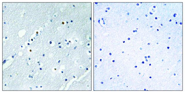 Anti-Histone H2B antibody produced in rabbit affinity isolated antibody