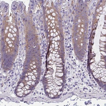 Anti-LPIN3 antibody produced in rabbit Prestige Antibodies&#174; Powered by Atlas Antibodies, affinity isolated antibody, buffered aqueous glycerol solution