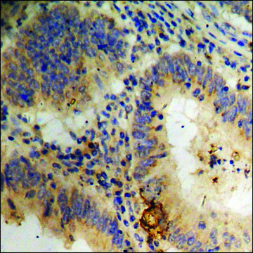 Anti-phospho-CRYAB/Crystallin-&#945;-B (pSer59) antibody produced in rabbit affinity isolated antibody