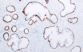 p40 (ZR8) Rabbit Monoclonal Antibody