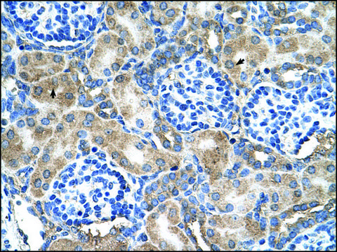 Anti-SOD1 antibody produced in rabbit IgG fraction of antiserum