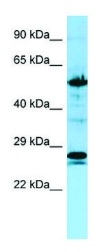 Anti-KRT6A (C-terminal) antibody produced in rabbit affinity isolated antibody