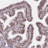 Anti-CREBBP antibody produced in rabbit Prestige Antibodies&#174; Powered by Atlas Antibodies, affinity isolated antibody, buffered aqueous glycerol solution