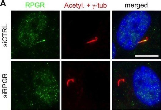 Anti-RPGR antibody produced in rabbit Prestige Antibodies&#174; Powered by Atlas Antibodies, affinity isolated antibody, buffered aqueous glycerol solution