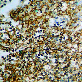 Anti-phospho-p53 (pSer37) antibody produced in rabbit affinity isolated antibody