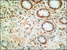 Anti-FUS antibody produced in rabbit ~1.0 mg/mL, affinity isolated antibody