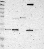 Anti-CD300A antibody produced in rabbit Prestige Antibodies® Powered by Atlas Antibodies, affinity isolated antibody, buffered aqueous glycerol solution
