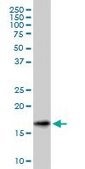 Monoclonal Anti-SNCG, (C-terminal) antibody produced in mouse clone 2C3, ascites fluid
